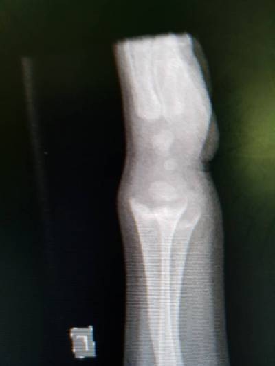 X-ray: LAT of the wrist